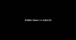 Zatürre nin tanı ve tedavisi
